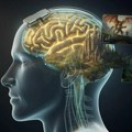 Neuralink i video-igre: Paralisani veteran igra World of Warcraft snagom misli
