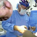 Presađen bubreg svinje u telo čoveka čiji mozak je mrtav, već mesec dana radi normalno