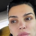 "Doktor mi je isekao više mesa i mog tkiva": Žena fudbalera prolazi kroz agoniju: "Ovo je horor film"