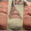 Miloš Bojanić (73) otišao na podmlađivanje: Prvo ga celog izmasirali, pa mu uradili anti-ejdž tretman lica, umotali ga u…