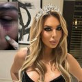 Prve fotografije brutalno pretučene Ave Karabatić Starleta iznela potresne detalje: Terao me je da se snimam protiv moje volje…