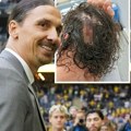 Zlatan Ibrahimović šokirao slikom na Instagramu: Gadno rasekao glavu, pa završio i sa šavovima na potiljku