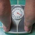 Kašanin: Borba protiv gojaznosti samo dugoročnim menjanjem navika u ishrani