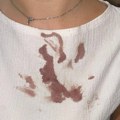 Studenti: Naša koleginica zlostavljana u policiji, udarana glavom o sto, pištoljem, vezana za radijator