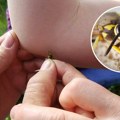 Kako je moguće da neko umre od uboda ose? Beograđaninu nije bilo spasa, a ovo su znaci reakcije opasne po život