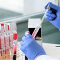 Gradovi pogođeni epidemijom ebole u Kongu ograničili kretanje stanovništva