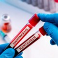 "Andski soj je drugačiji": Lekari objasnili kako se prenosi hantavirus sa kruzera
