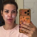 Bivša voditeljka (42) u suzama, pokazala lice nakon požara koji je izbio kod njene luksuzne vile u Vrdniku: "Pamtiću ovo dugo"…