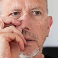 Umalo fatalno čačkanje nosa: Pacijent poslat na hitnu operaciju nakon sumanute nesreće