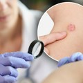 Besplatan pregled mladeža ispred zgrade Opštine Novi Beograd