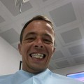 Uradio zube u Turskoj, a onda jedan po jedan počeo da ispada: "Nisam želeo da čitam o posledicama..."