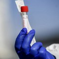 Trenutak nepažnje bio koban: Laboratorijska radnica razbila epruvetu i umrla od kuge