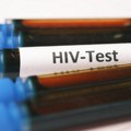 Zavod za javno zdravlje Zrenjanin: Besplatno testiranje na HIV