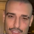 Darko Lazić saopštio drastičnu odluku dve nedelje nakon udesa