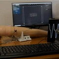 Flaster umesto skalamerije za pritisak Evo kako srpska nauka uvodi novu tehnologiju u polje telemedicine