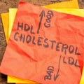 ХДЛ холестерол: Како повећати „добар“ холестерол