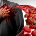 Kardiovaskularne bolesti su najčešći uzrok smrti: Kardiolog otkriva načine prevencije