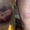 U izbornoj noći, kako tvrdi advokat, policija uhapsila i pretukla Užičanina