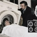 Na današnji dan: Pre 55 godina urađen prvi CT snimak čoveka – trenutak koji je promenio medicinu Prvi CT snimak čoveka