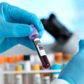 Medicina i Velika Britanija: Test krvi za 50 vrsta kancera ohrabrio naučnike