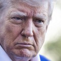 Šta je hronična venska insuficijencija? Bolest Donalda Trampa može da dovede do rana koje se lako inficiraju