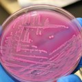 Bakterije pamte i donose „odluke“