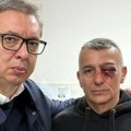 (Foto) Vučić obišao policajca povređenog ispred RTS: "Zadobio je teške telesne povrede, udarili su ga bokserom"