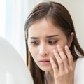 Imate žućkaste naslage oko očiju? Mogu ukazati na veći rizikom od infarkta i moždanog udara