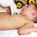 Potvrđen još jedan slučaj malih boginja: Većini obolelih jedna stvar zajednička, raste interesovanje za mmr vakcinu