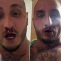 Krv mu curi iz nosa, spomenuo i batine! Srpski reper usred noći objavio jeziv snimak! (foto)