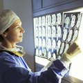 Magnetna rezonanca i CT skener – kad treba ići na ova snimanja i koje bolesti otkrivaju