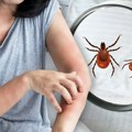 Ujed buve ili stenice: Kako razlikovati tragove na koži uz pomoć tri tačke i cik-cak linije