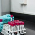 Fajzer dobio odobrenje u SAD za novu genetsku terapiju protiv hemofilije