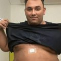 Prvi snimak bivšeg zadrugara nakon operacije: Podigao majicu i pokazao telo, stomak oblepljen flasterima (video)