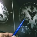 Naučnici otkrili novu funkciju malog mozga