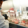 U Srbiji oko 400 obolelih od cistične fibroze, u avgustu se očekuje novi inovativni lek