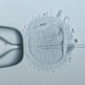 Doktori prijavili prvu trudnoću uz pomoć nove procedure pomoću veštačke inteligencije