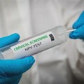 HPV otkriven kod svake osme testirane žene u Srbiji