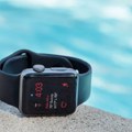 Apple plaća 20 miliona dolara zbog baterije Apple Watch