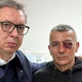 Predsednik Vučić obišao policajca koji je povređen ispred RTS-a: "Toliko o mirnim demonstrantima i nadasve ugroženim"