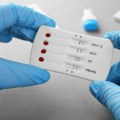 Veliki korak u borbi protiv HIV-a: Novi materijal ruskih naučnika smanjio virus 100.000 puta