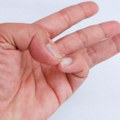 Dodirnite mali prst palcem i proverite da li ste evoluirali: Samo 15% ljudi nema ovaj mišić
