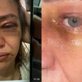 Nokautirao je, pa je vukao po podu: Influenserka podelila jezive slike i snimak "Živela sam u strahu šta..."