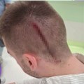 Dvostruki aršini za napadače i napadnute studente