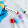 Manjak testosterona: Zbog čega se javlja, koje su posledice i kako se leči?