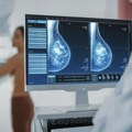 Ponovo pregledi mobilnim mamografom – ko može da se prijavi i šta je potrebno