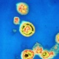 Proboj u traganju za lijekom protiv HIV-a