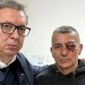 Vučić objavio sliku sa policajcem: Napali su ga plenumaški boljševici