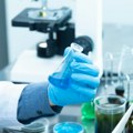 Naučnici Razvili metodu za uništavanje virusa HIV Ovo ga čini potpuno bezopasnim