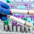 Nova dva soja koronavirusa sa različitim simptomima: SZO izdala nova uputstva za lečenje inficiranih